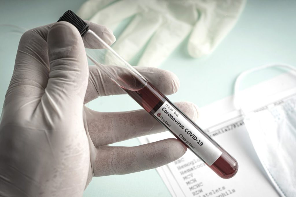 118 new cases of coronavirus in Samtskhe-Javakheti 118 new cases of coronavirus in Samtskhe-Javakheti