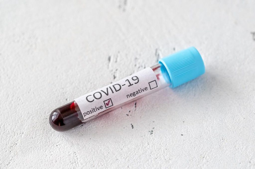 5 new cases of coronavirus in Samtskhe-Javakheti 5 new cases of coronavirus in Samtskhe-Javakheti